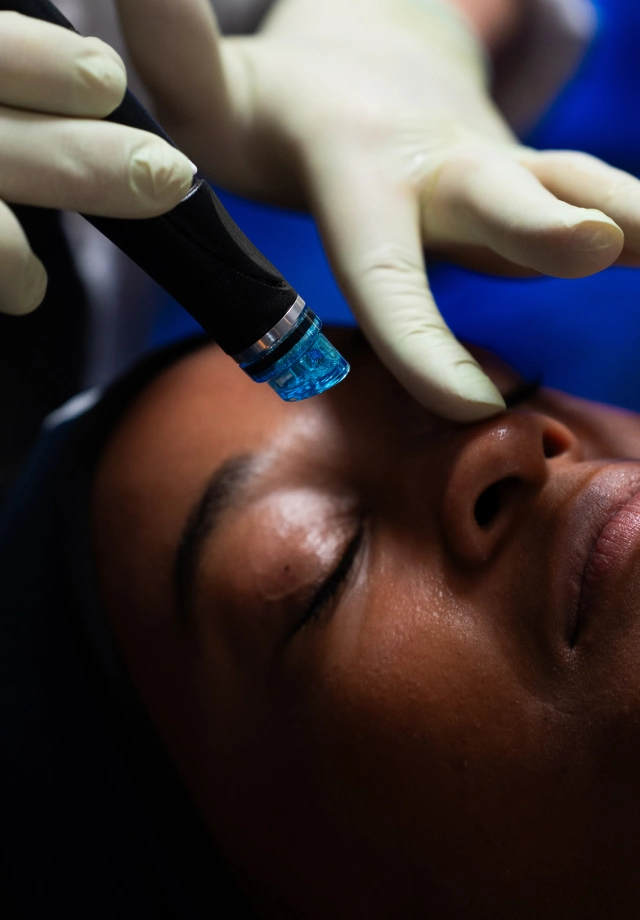 Woman receiving a Hydrafacial from Restore