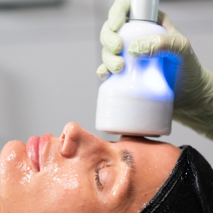 Customer receiving Neveskin Facial in Mt. Kisco, NY