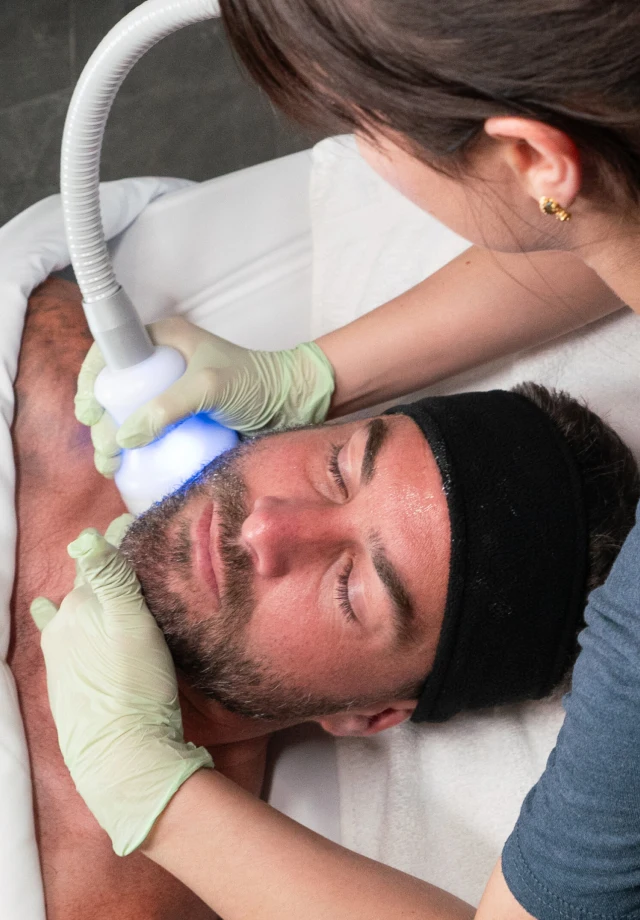 Man receiving Neveskin™ facial on his cheek