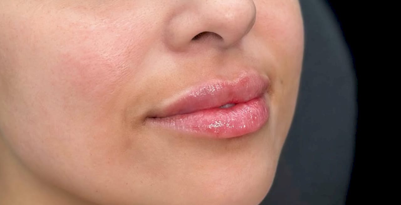 Lip Flip