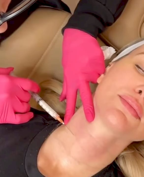Platysmal Band Botox: FDA Label, Results & What to Expect