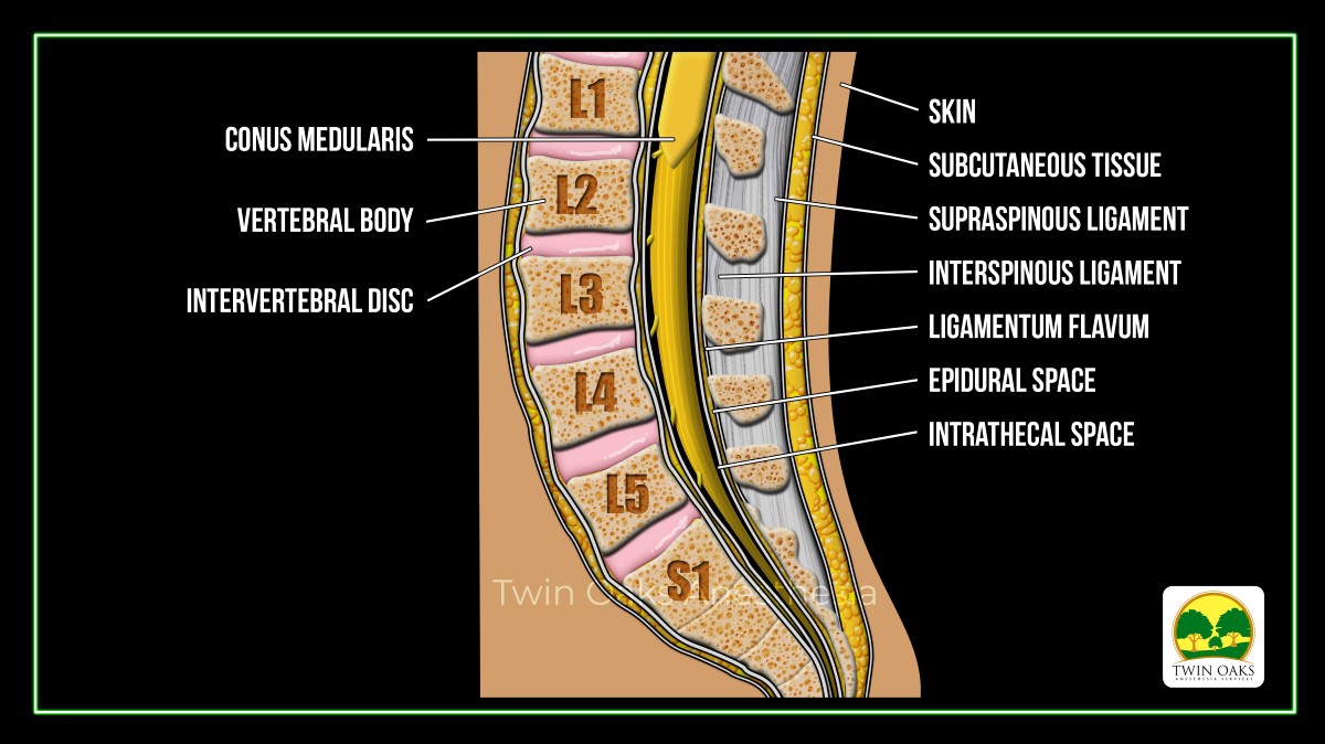 Image of side view of spinal cord and labeled anatomy