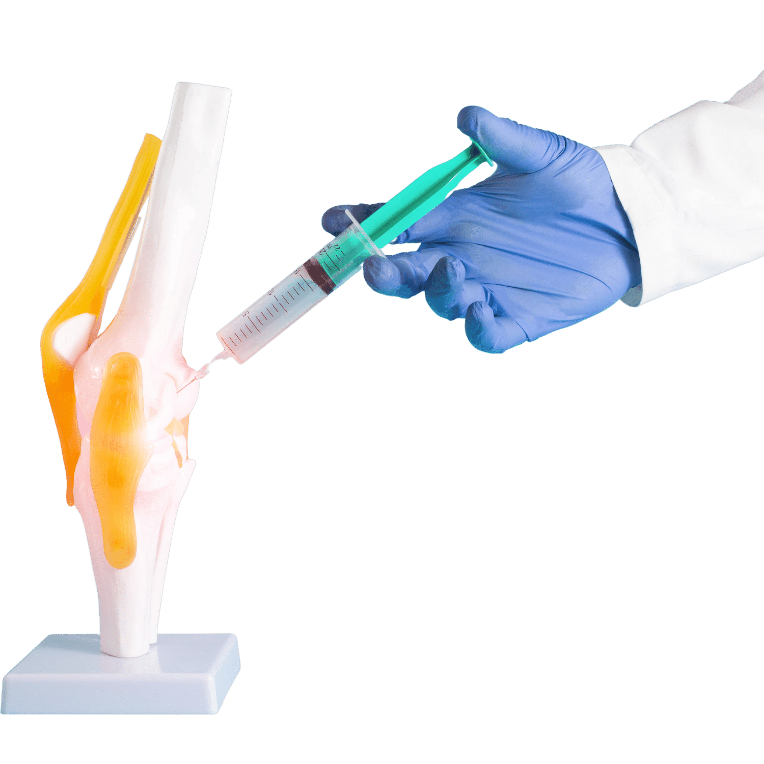 Syringe placing an injection into a knee joint model