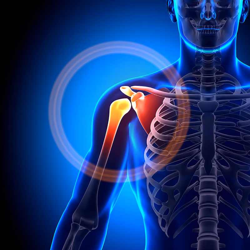 Shoulder Pain Xray