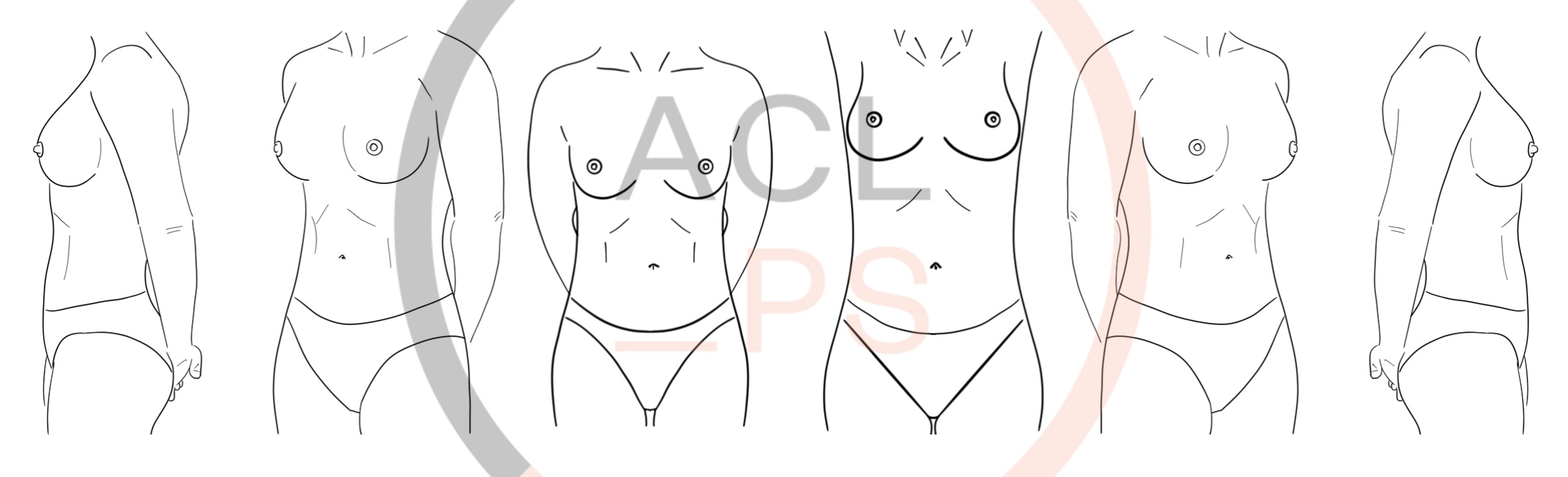 Explant risks vs. Breast augmentation risks: is there a double standard?