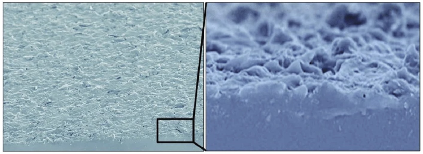 Motiva silk surface breast implants: are they any better?