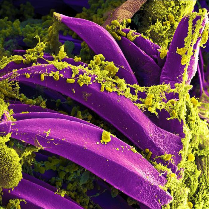 Suspected Plague Death at a Russian Lab Puts Nearly 200 Under Watch