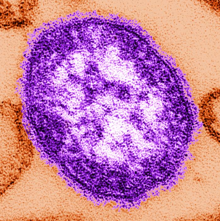 Pennsylvania Measles Outbreak Passes 1,300 Cases With 5 Deaths
