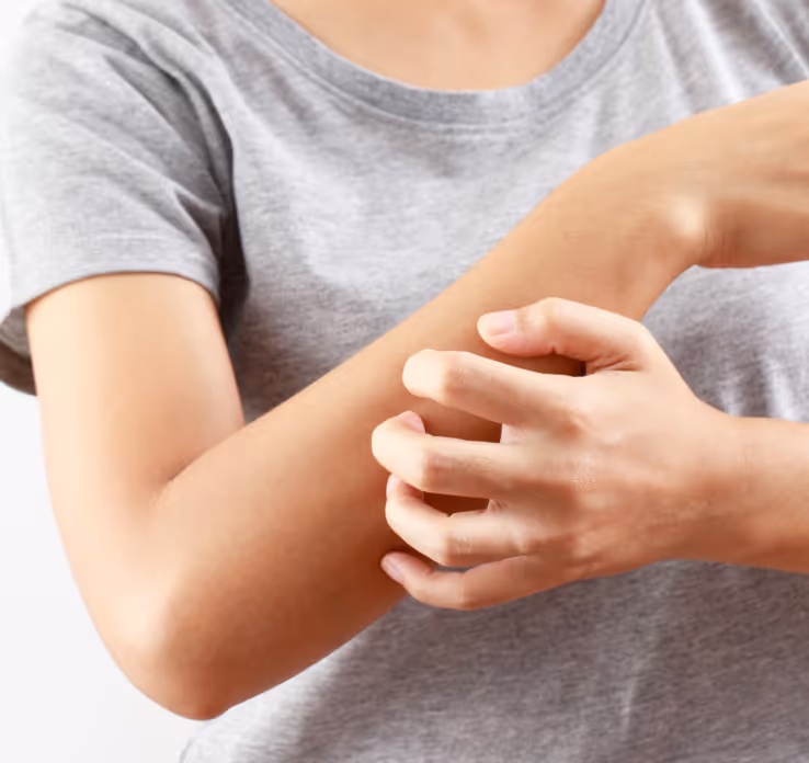 Scratching an itch because of allergies