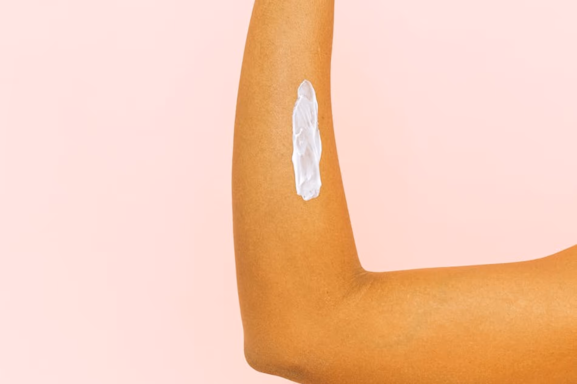 Moisturizers for eczema/atopic dermatitis patients 