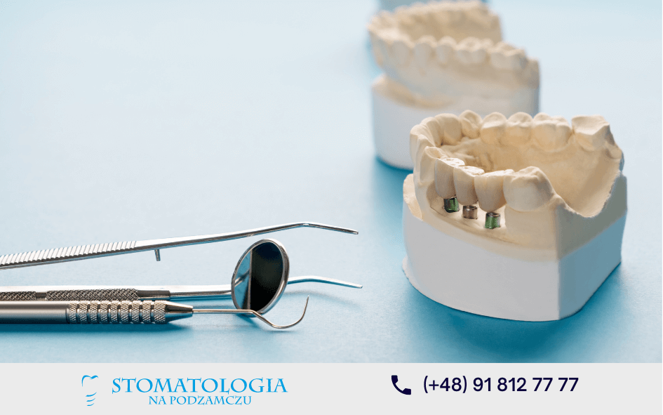 co-to-jest-osteointegracja