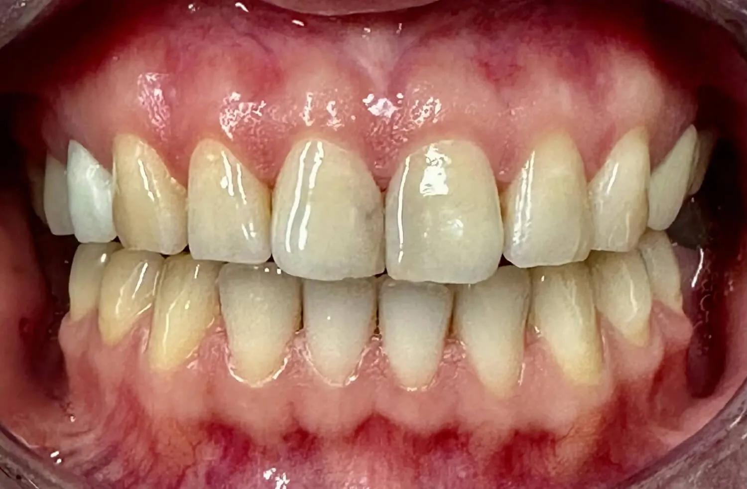 Before Image