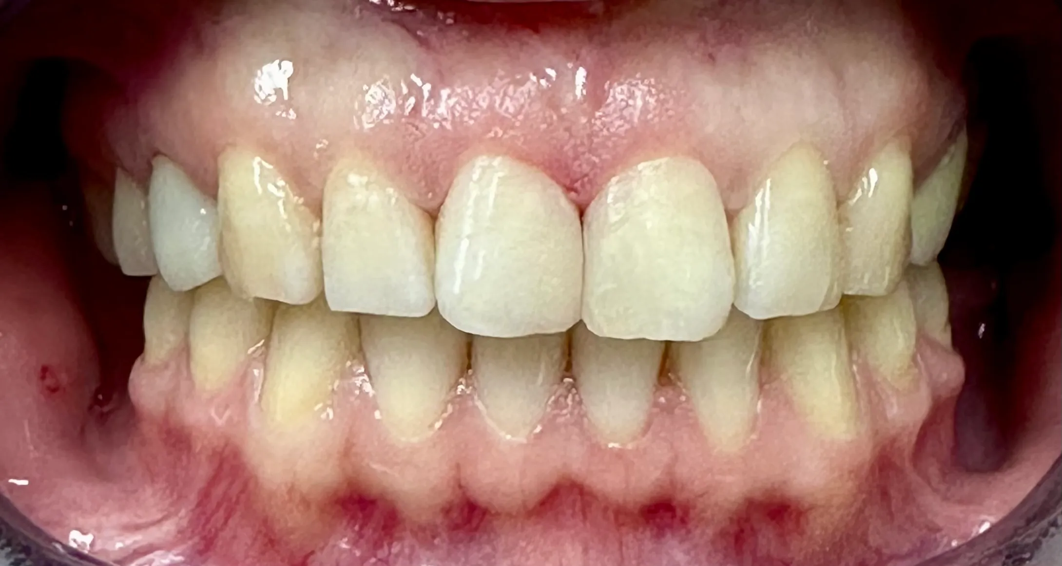 After Image