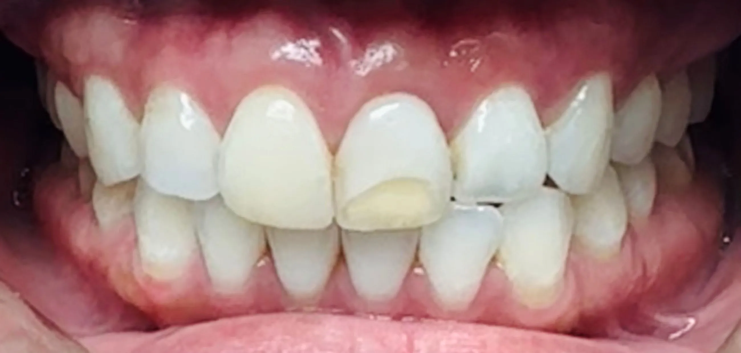 Before Image