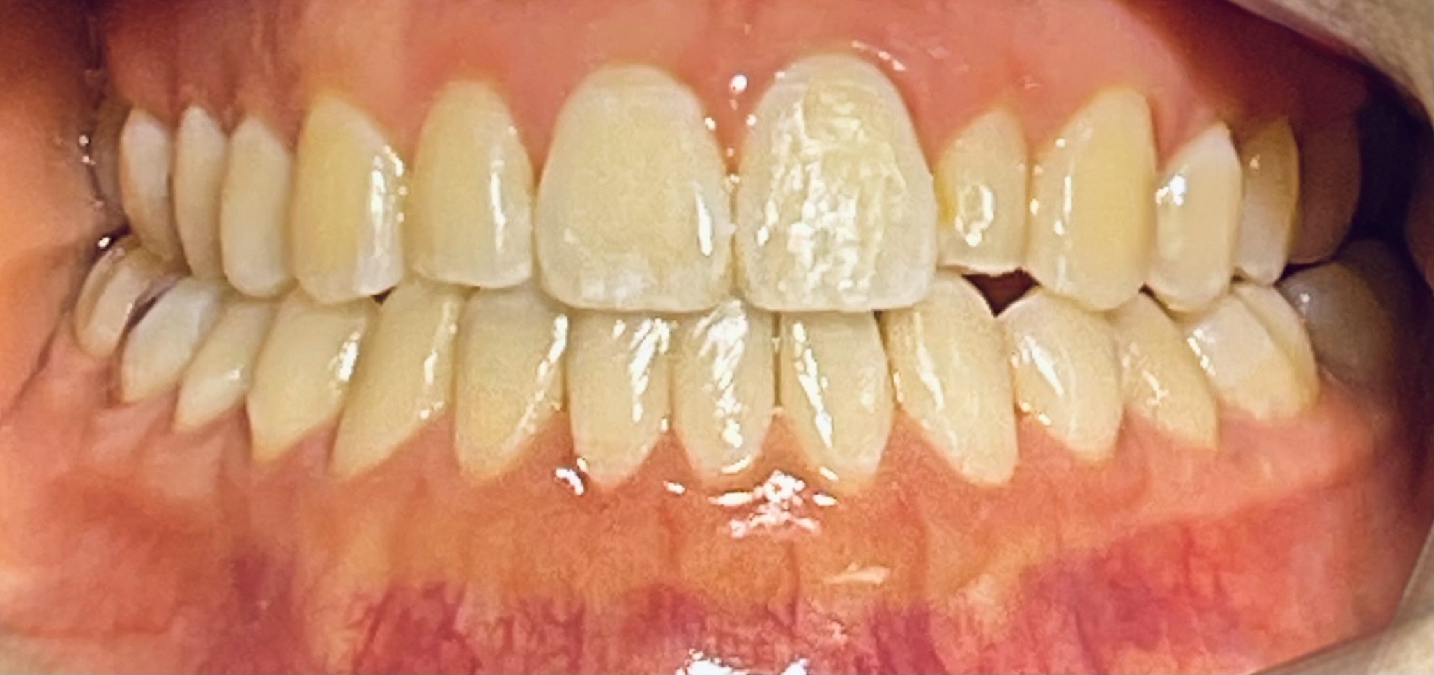 After Image