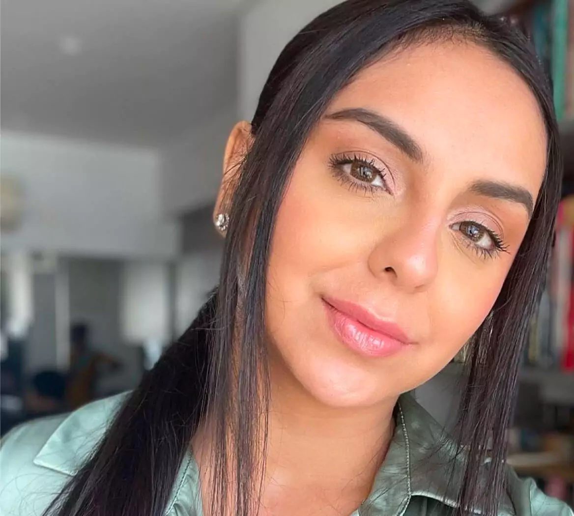 Aanam Chashmawala on her relationship with her skin after getting fillers