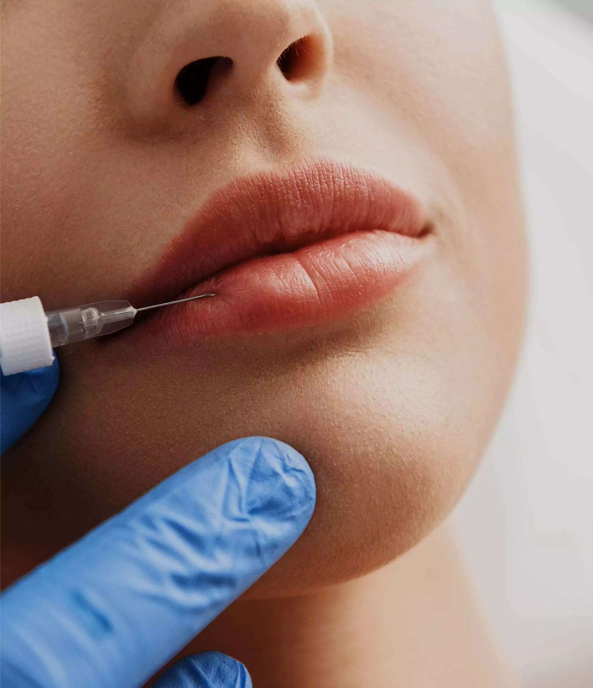 Aanam Chashmawala on her relationship with her skin after getting fillers