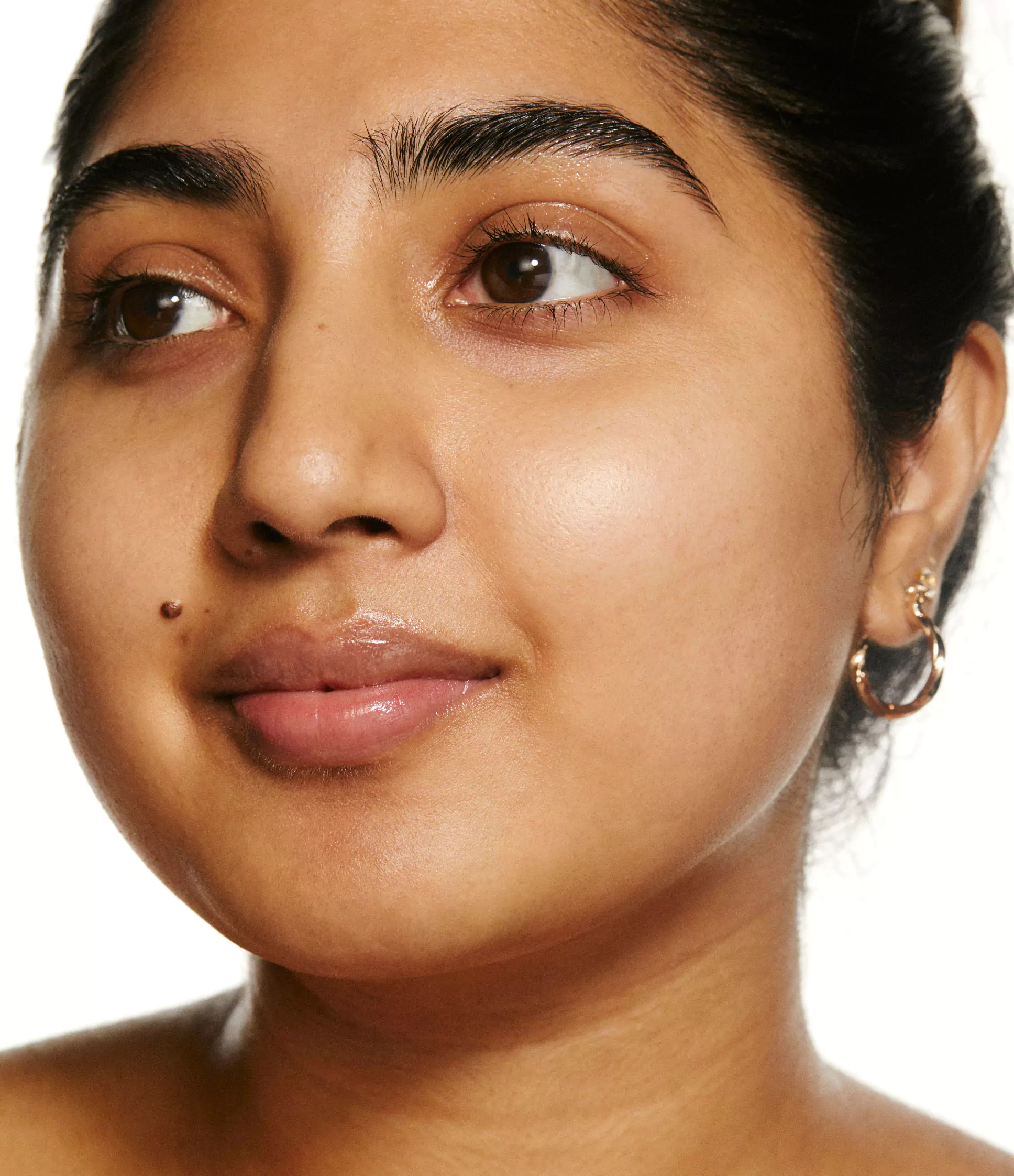 Azelaic acid: the unsung hero for acne