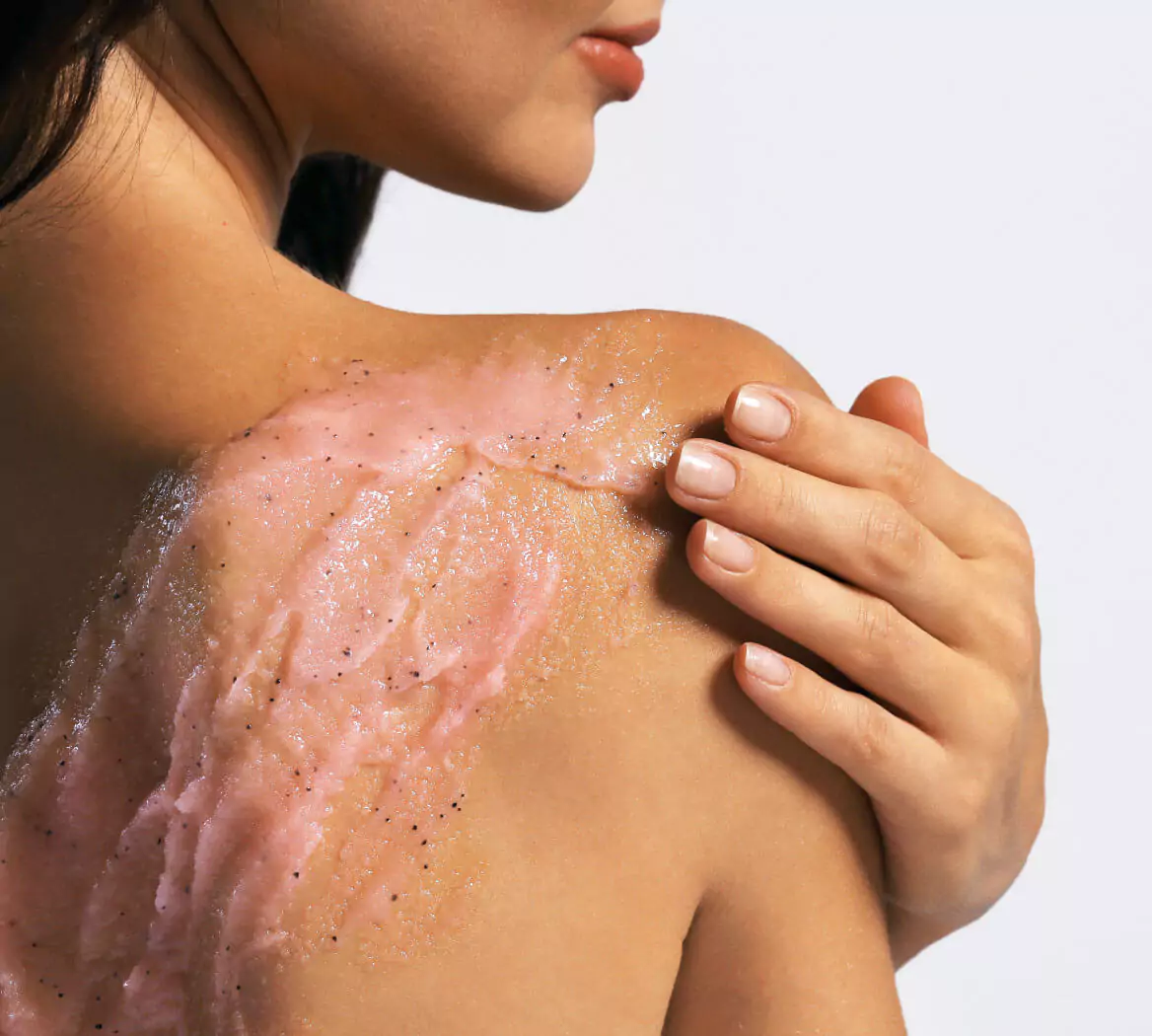 This is the best way to treat back pimples, according to an expert