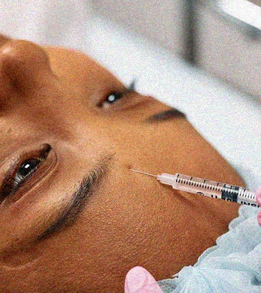 Dr Monica Jacob on everything you need to know about getting and removing dermal fillers