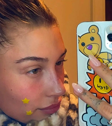 Pimple patches: effective solutions or just gimmicks?