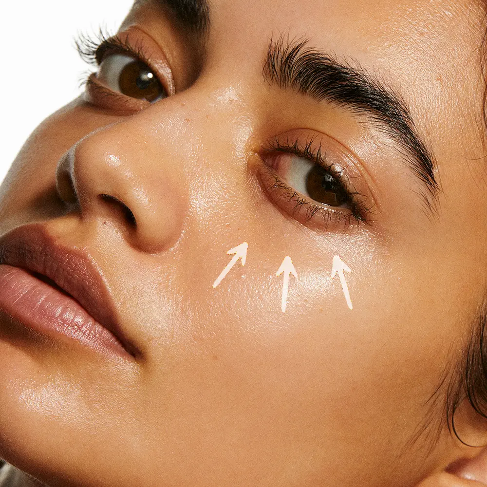 Your ultimate guide to dark circles (and how to treat them)
