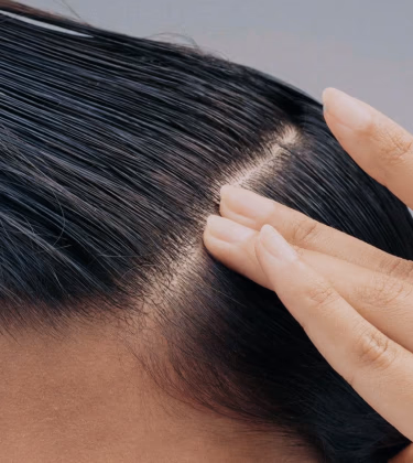 Your go-to winter haircare guide for hydrated, healthy strands