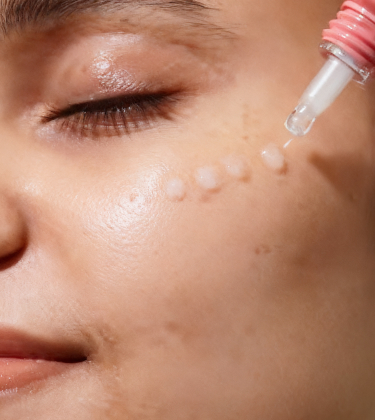 What are spicules? A dermatologist’s guide to the ingredient behind microneedling