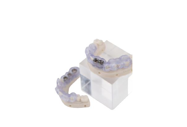 Prothèse Partielle Métallique