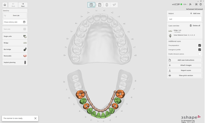 Étape 1 — Activation du cas All-on-X dans TRIOS