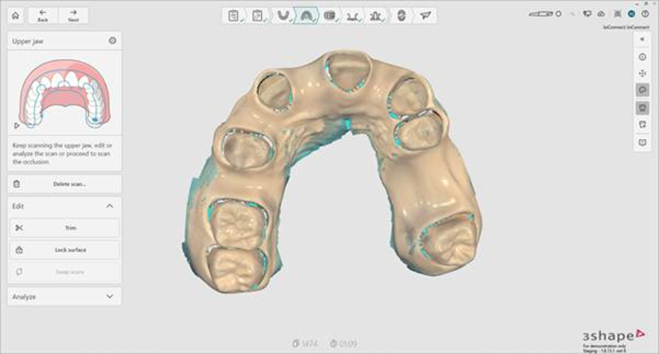 Étape 4 — Scan de l’antagoniste