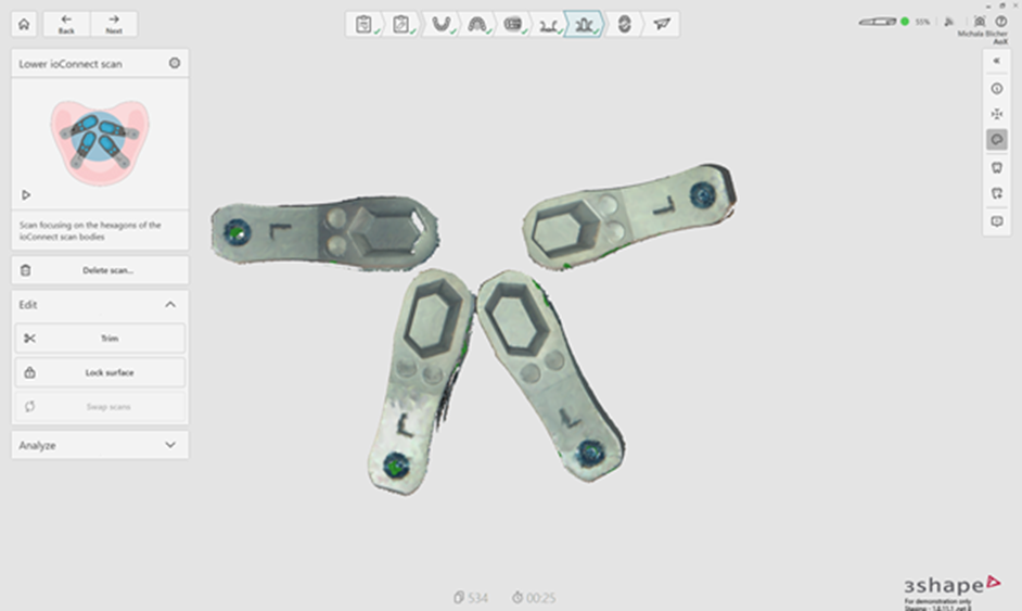 Étape 7 — Trim complet et scan des ioConnect scan flags