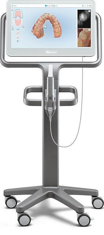 iTero Element 5D en utilisation clinique