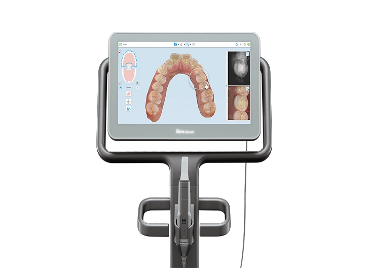 iTero Element 5D - Premier système d'imagerie hybride