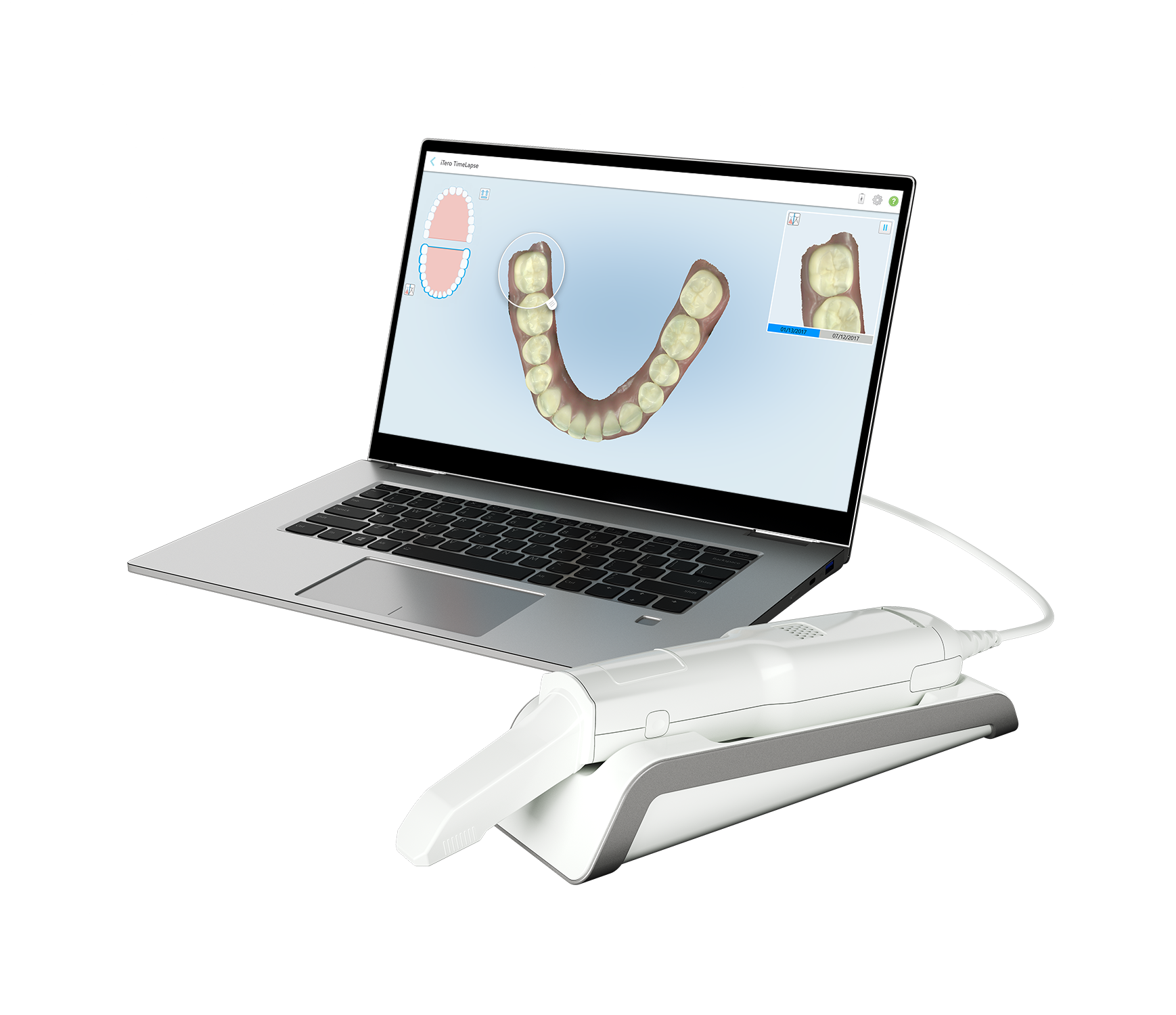 iTero Element Flex - Scanner intra-oral portable