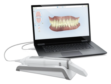 iTero Element Flex portable avec ordinateur