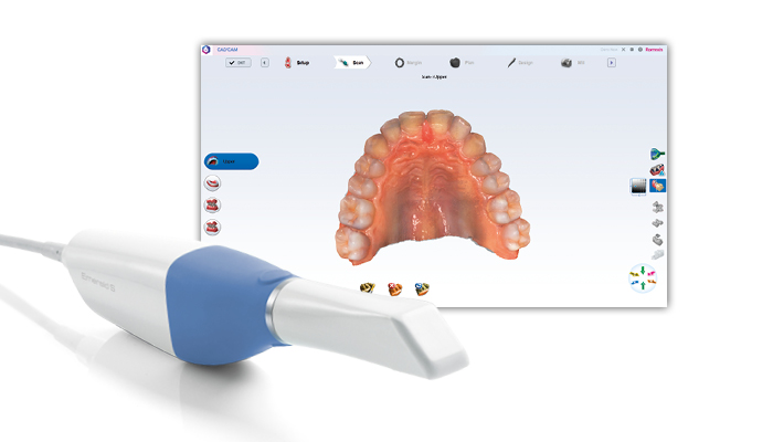 Planmeca Onyx - Scanner intra-oral nouvelle génération