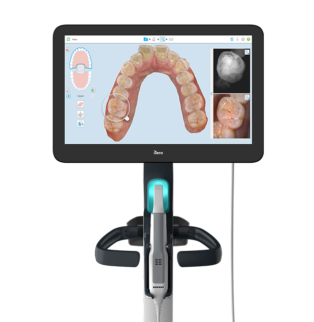 iTero Element Plus Series - Scanner intra-oral nouvelle génération