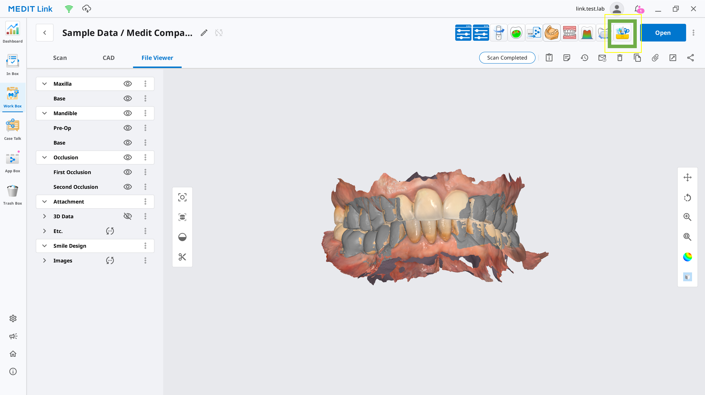 Dashboard Case Box de Medit Link avec un cas patient en cours et l'aperçu 3D du scan