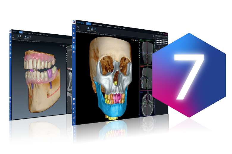 Le logiciel d'imagerie dentaire Romexis® 7.