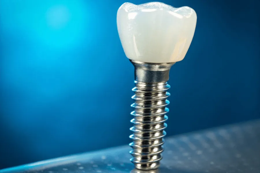 implant-zeba-stomatologia-edent-warszawa