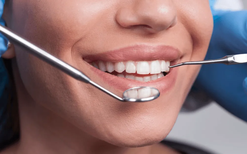 licowkowy-efekt-bondingu-zebow-warszawa-bemowo-edent