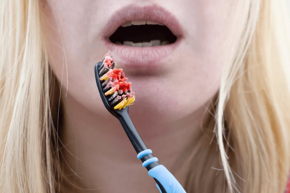 paradontoza-na-czym-polega