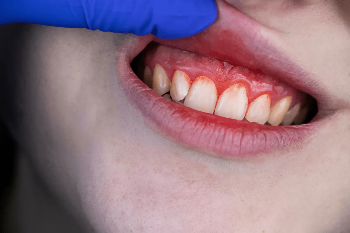 konsultacja-u-periodontologa-warszawa