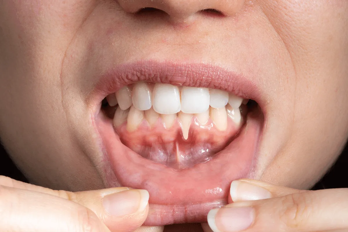 periodontologia-edent-warszawa