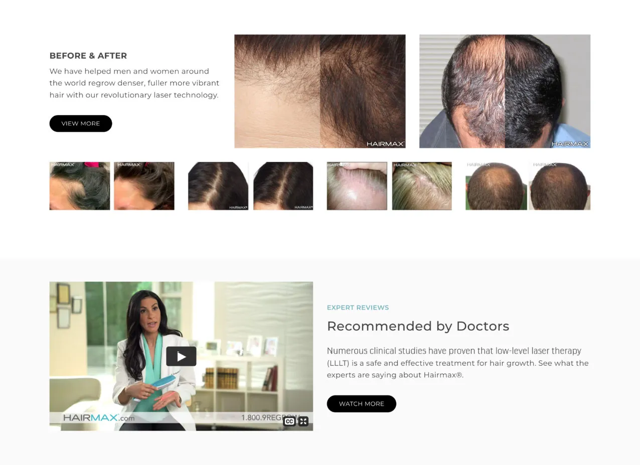 Screenshot from web design created for Hairmax, a Designity client.