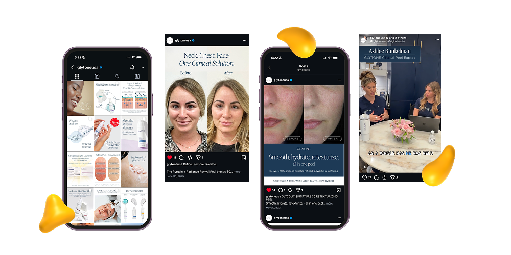 Educational Instagram content for Glytone featuring before-and-after skincare treatments and expert-led clinical product demonstrations for provider marketing
