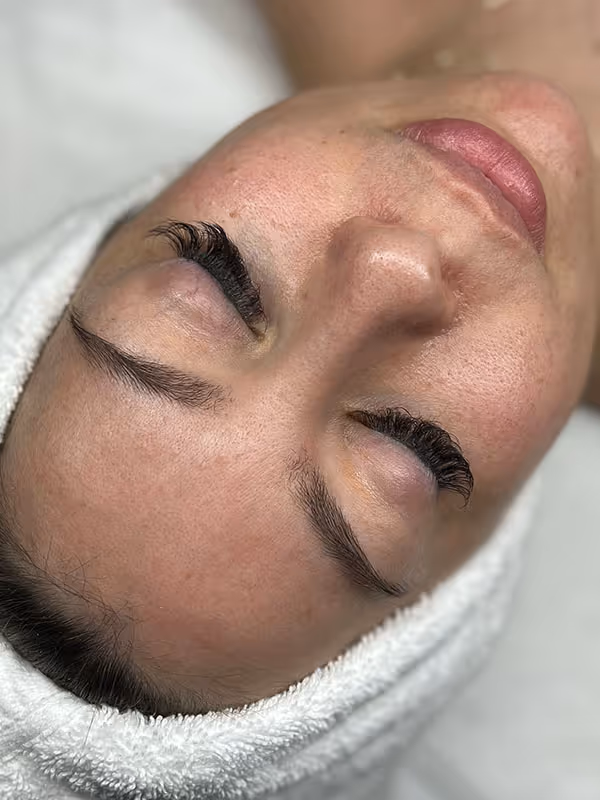 LORILEE_HYDRAFACIALPLATINUM_FACIAL