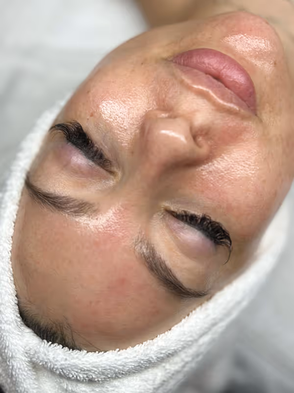 LORILEE_HYDRAFACIALPLATINUM_FACIAL