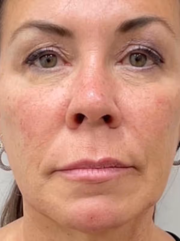 JOCELYN_LIQUIDFACELIFT